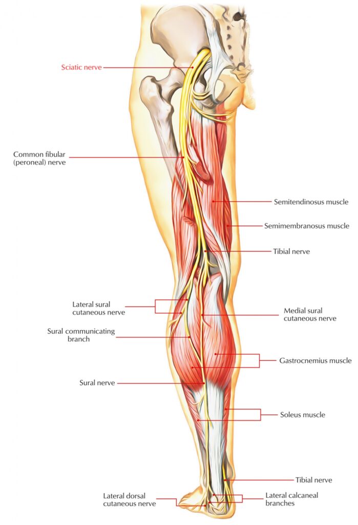 Sciatica pain relief with massage #sciatica #sciaticarelief #massge #m