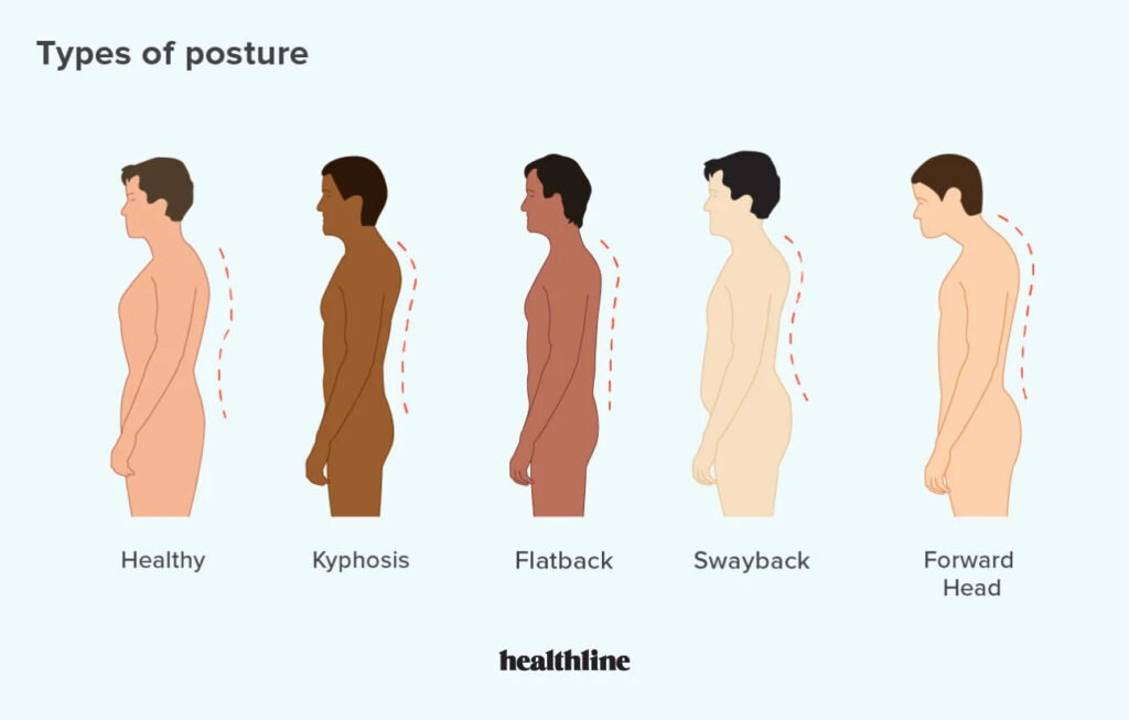 informational graphic depicting the different types of posture