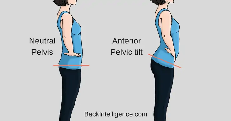 neutral pelvis s anterior pelvic tilt