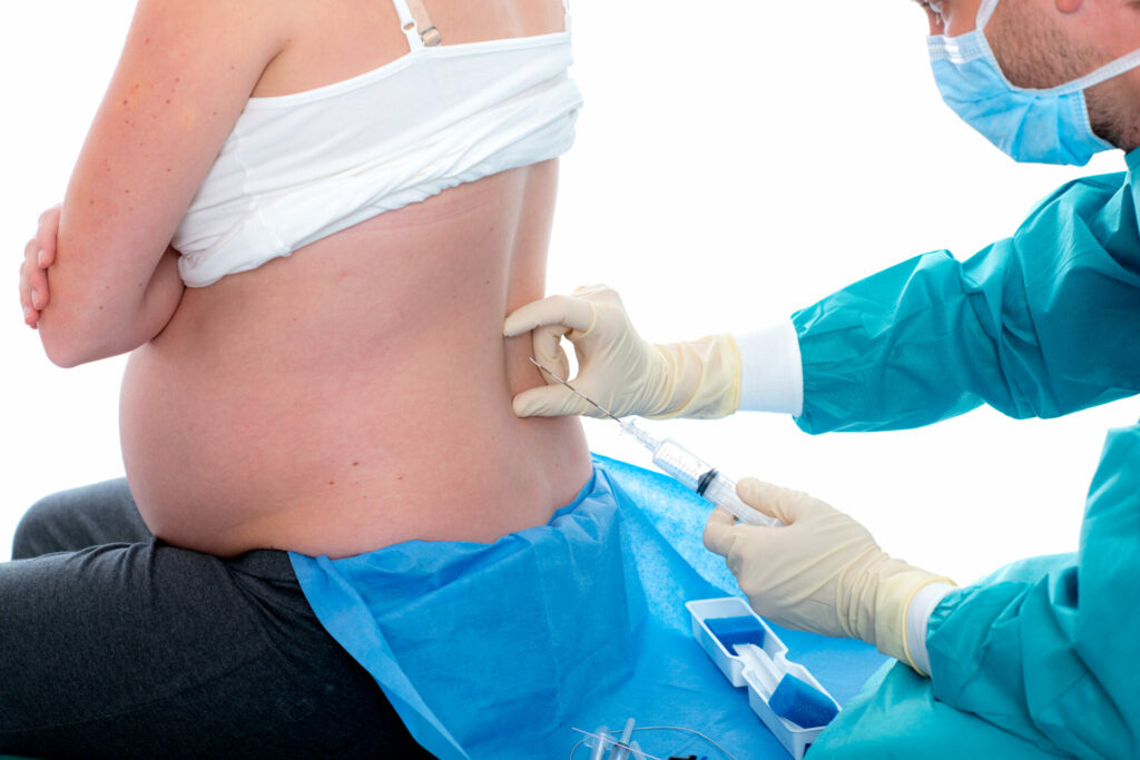 pregnant woman being administered an epidural