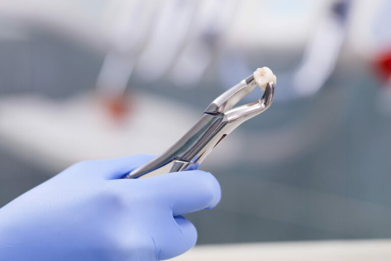 does tooth extraction hurt featured image
